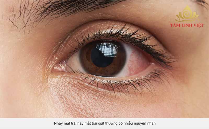 Nháy mắt trái hay mắt trái giật thường có nhiều nguyên nhân