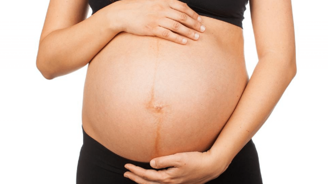 Dựa vào đường Nigra ở dưới bụng