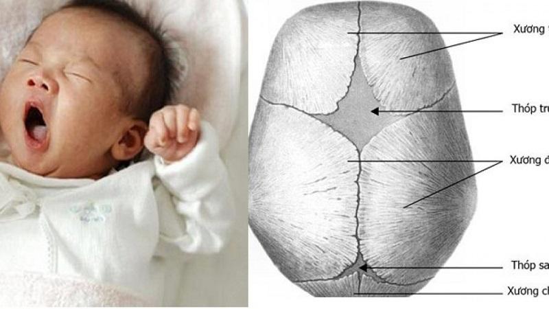 Những điều mẹ cần biết về thóp của em bé
